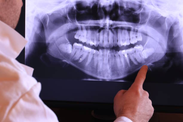 Best Emergency Tooth Extraction in Heber, CA